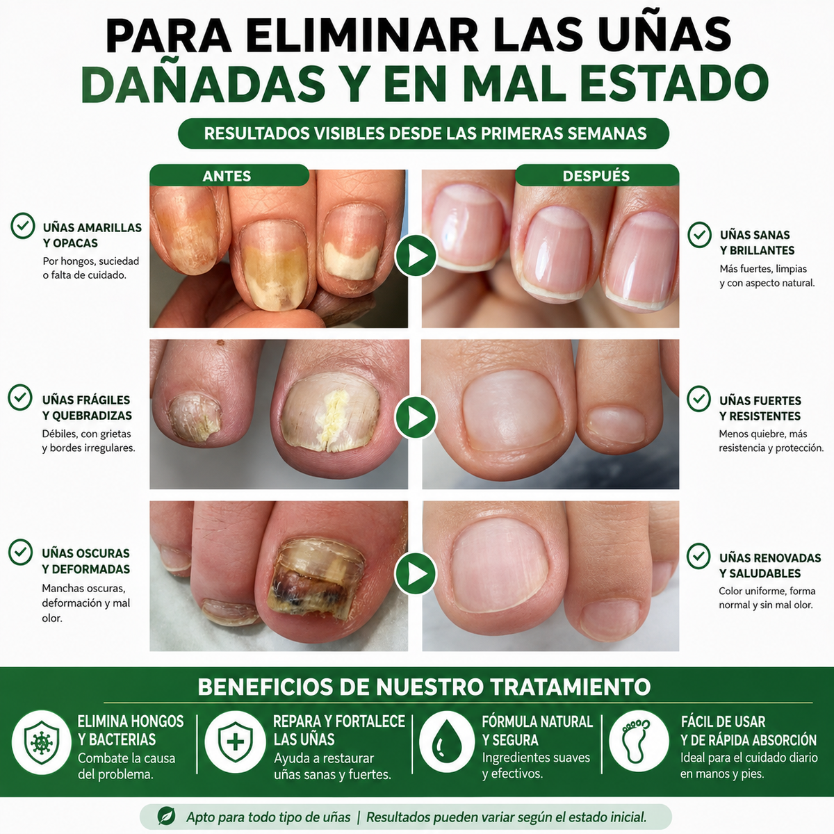 PureNail - Suero para tratamiento de uñas con hongos en 7 días